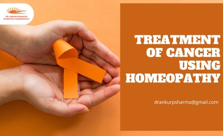 Treatment of Using homeopathy