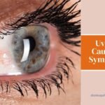 Treatment Options For Uveitis
