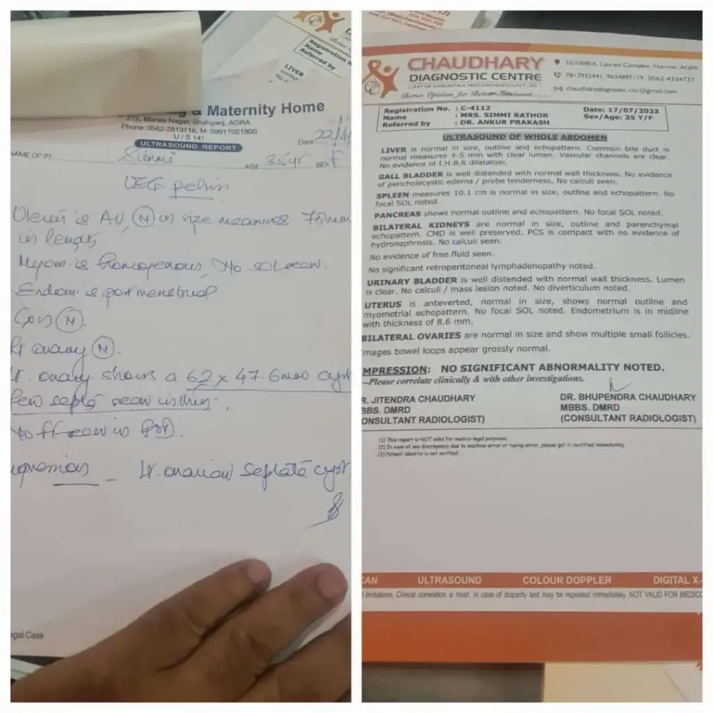 Cancer Treatment