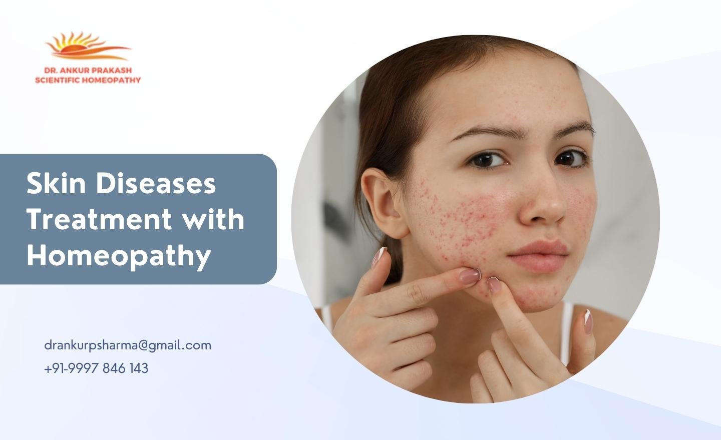 Understanding Skin Diseases