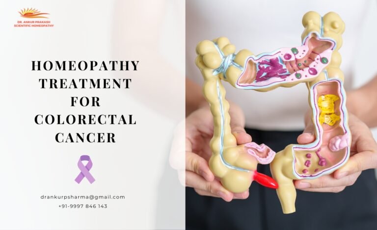 Homeopathy Treatment for Colorectal Cancer