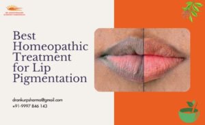 Achieve Natural Lip Hue with Homeopathy