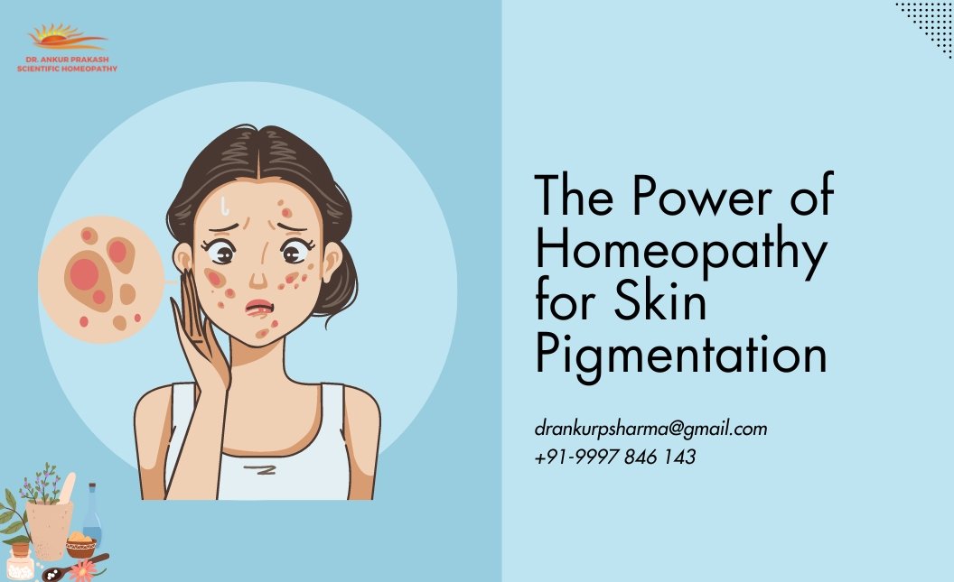 Illustration of a concerned woman with skin pigmentation issues alongside text promoting homeopathy for skin pigmentation, with contact information for Dr. Ankur Prakash.