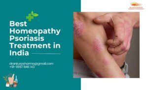 An advertisement for homeopathy treatment showcasing an individual's arm with visible skin irritation