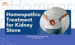 A promotional image for homeopathic kidney stone treatment