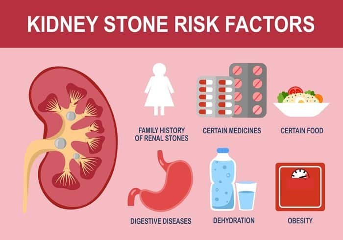 Causes of Kidney Stone