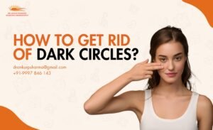How to Get Rid of Dark Circles? - Dr. Ankur Prakash Scientific Homeopathy