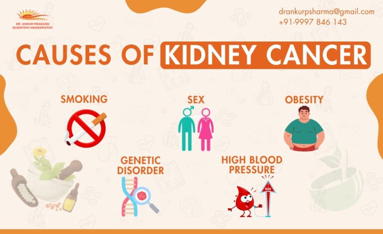 Image showing causes of kidney cancer