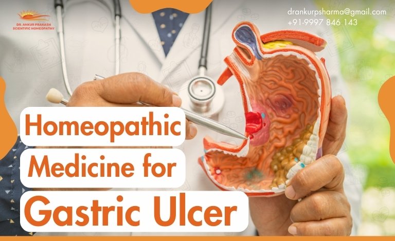 Doctor holding a stomach model for gastric ulcer treatment with homeopathy.