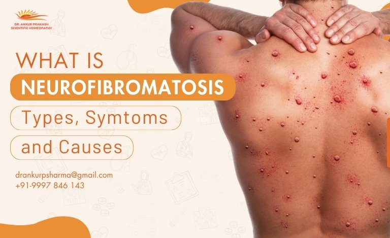 What is Neurofibromatosis: Types, Symptoms, and Causes," and contact details of Dr. Ankur Prakash Scientific Homeopathy.