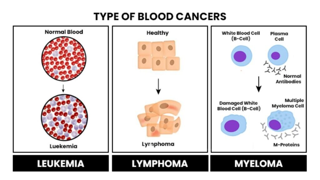 how can blood cancer be cured how can blood cancer be cured