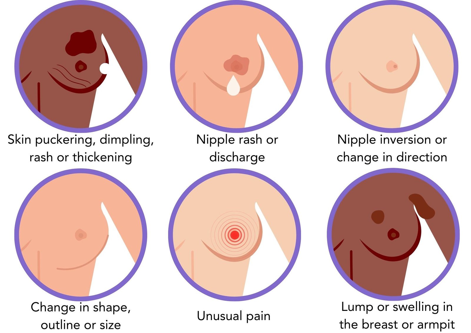 breast cancer symptoms