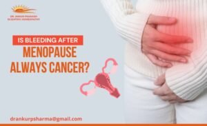 Is Bleeding After Menopause Always Cancer