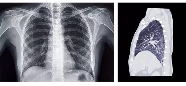 what is a ct scan used for