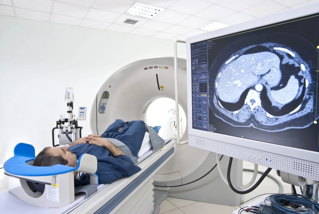 what were the result of ct scan