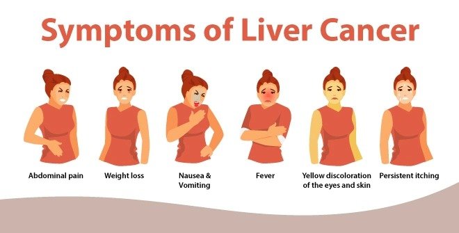 First Signs of Liver Cancer First Signs of Liver Cancer