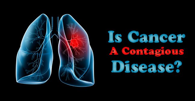 Is Cancer Contagious? Facts and Myths About Cancer
