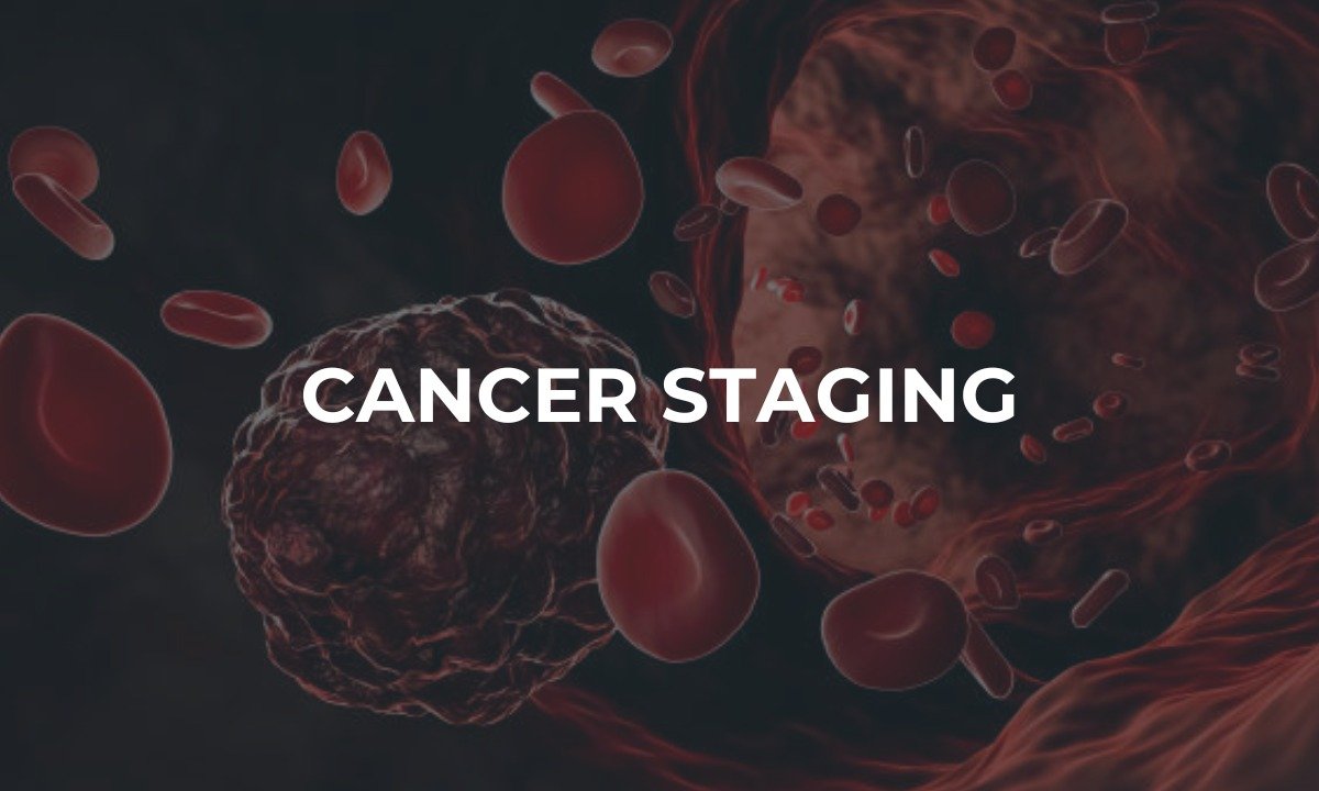 Cancer Staging