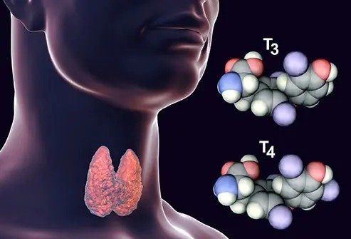 Symptoms of high TSH / hypothyroidism