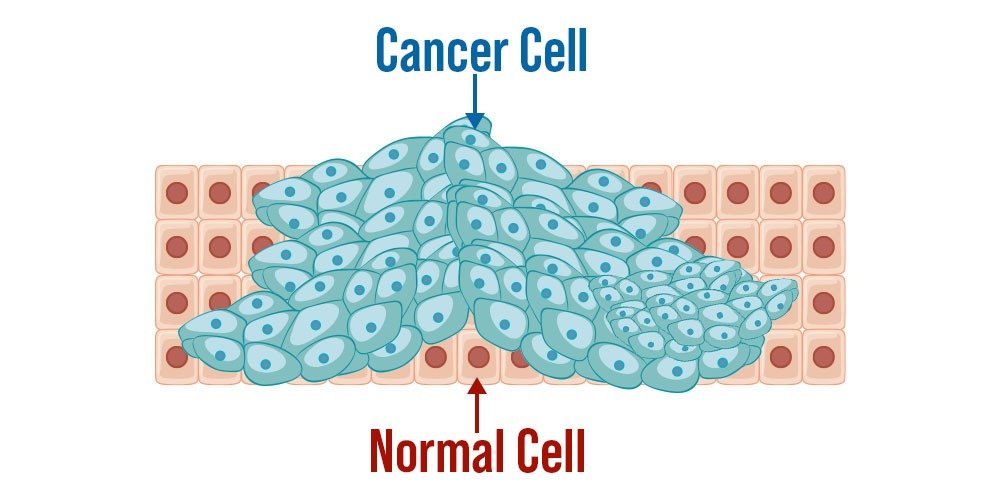 Why Cancer Doesn’t Spread Like Infections?