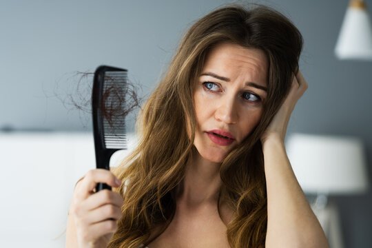 What is Hair Fall?