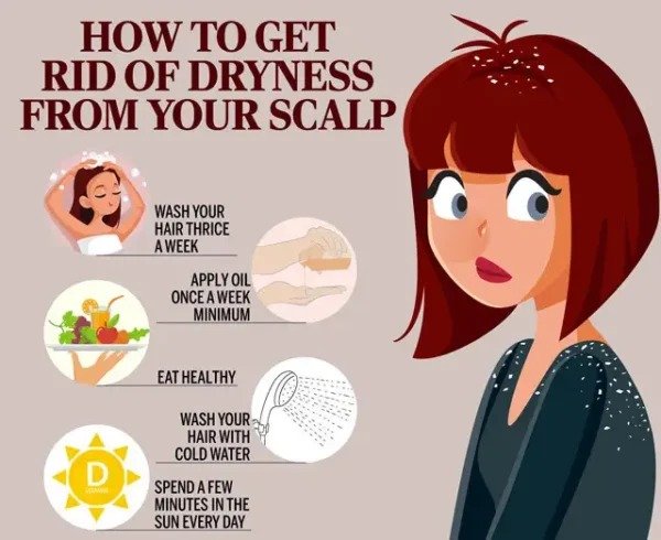 How to Get Rid of Dandruff?