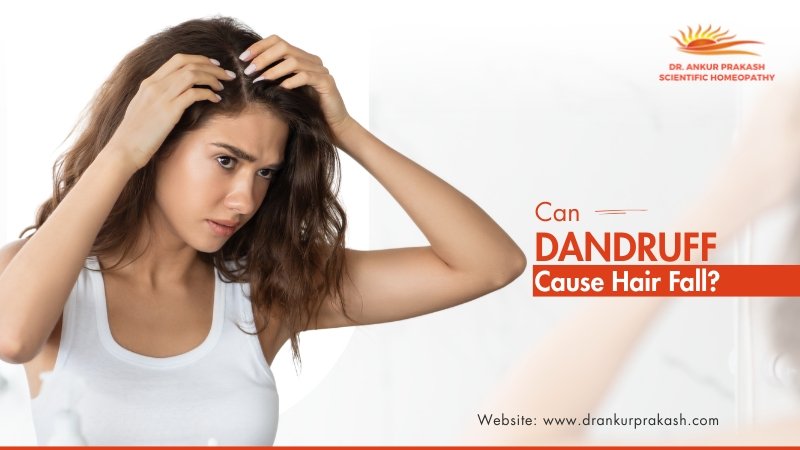 Can Dandruff Cause Hair Fall?
