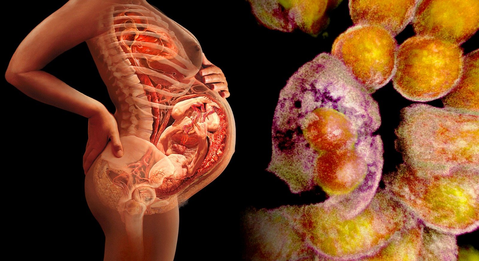 Does Cancer Spread During Pregnancy or Breastfeeding?