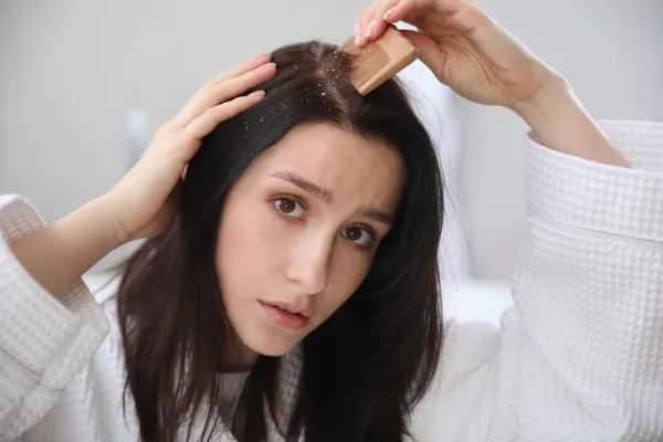 How to Get Rid of Dandruff?