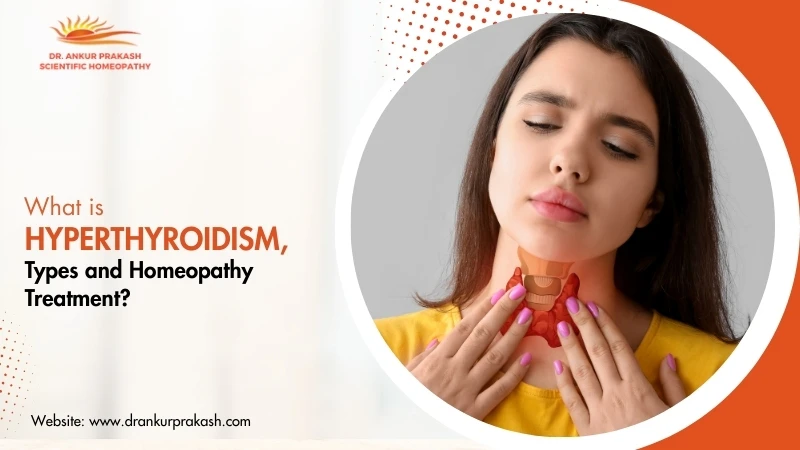 Homeopathic Medicine for Warts & Treatment in India