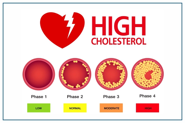 homeopathic medicine for high cholesterol