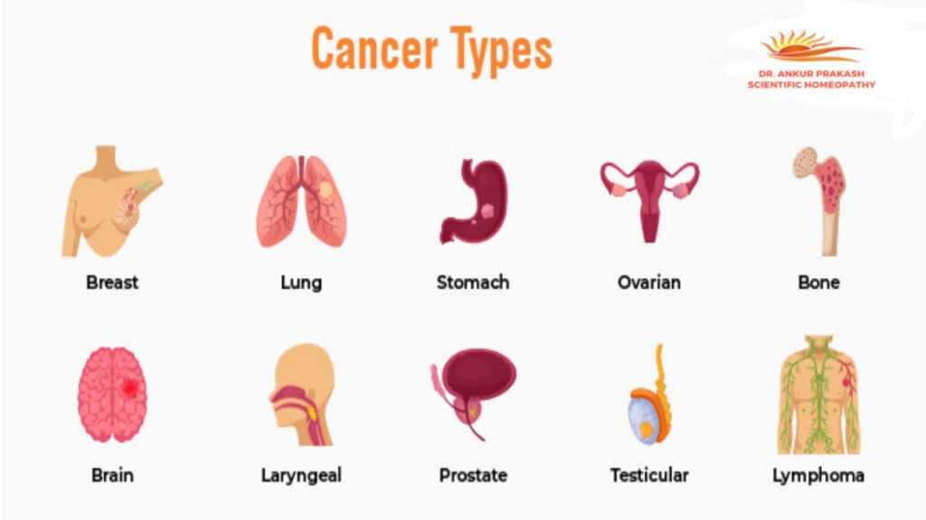 Types of Cancer
