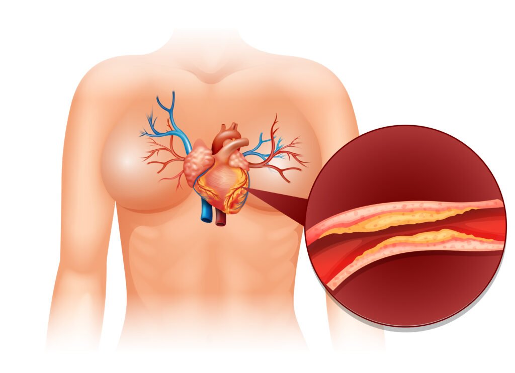 What is Cholesterol in Human Body​?