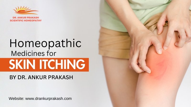 Homeopathic Medicines for Skin Itching in India with Dr Ankur Prakash