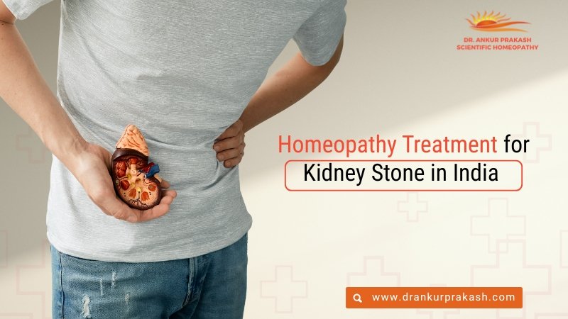 Homeopathy Treatment for Kidney Stone in India with Dr Ankur Prakash
