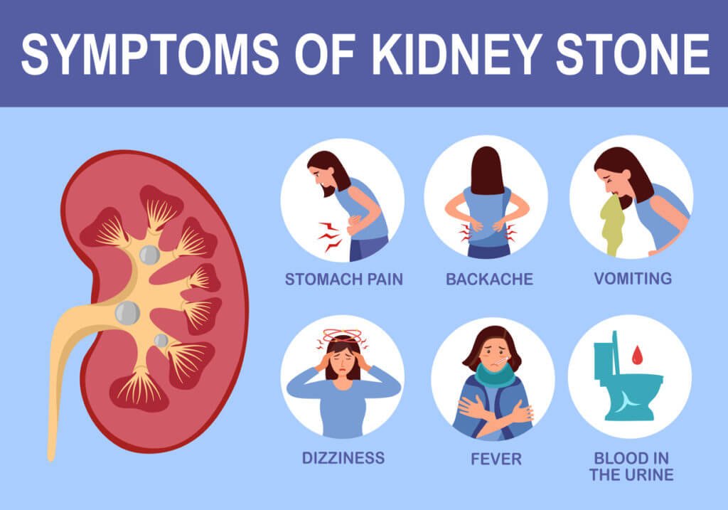 Common Symptoms of Kidney Stones