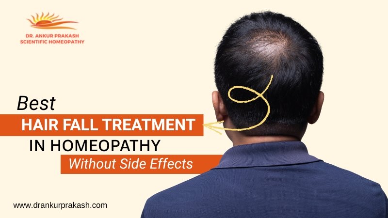Homeopathic Treatment for Hair Fall