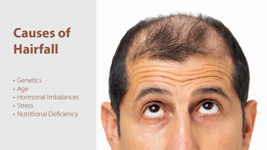 Common Causes of Hair Fall