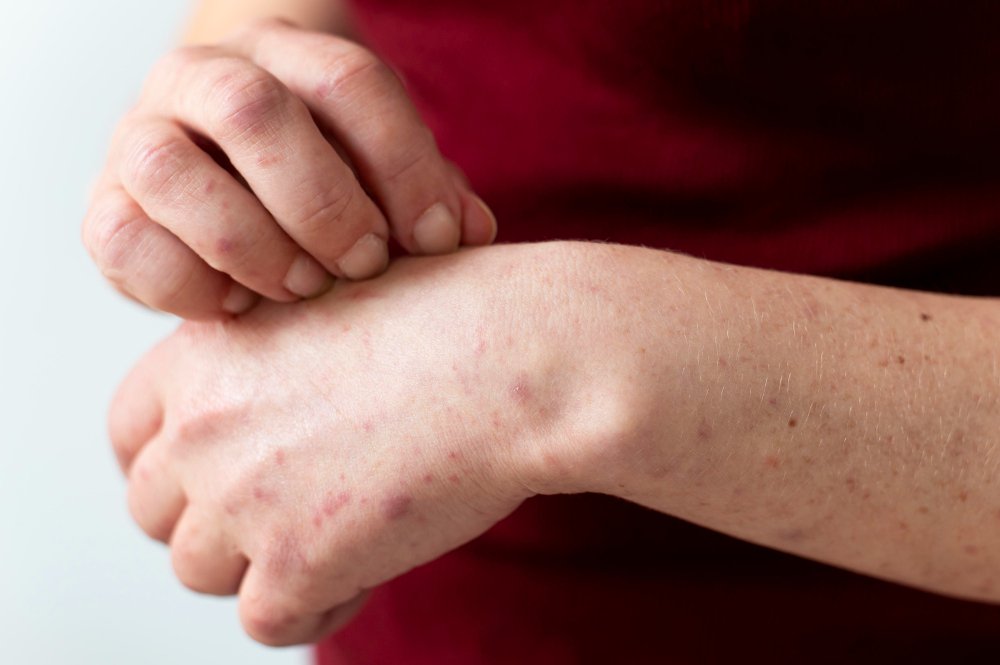 What Types of Cancer Can Cause Itchy Skin?