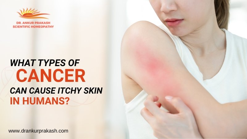 What Types of Cancer Can Cause Itchy Skin?