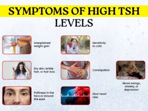 Common symptoms of high TSH levels including weight gain, cold sensitivity, and fatigue