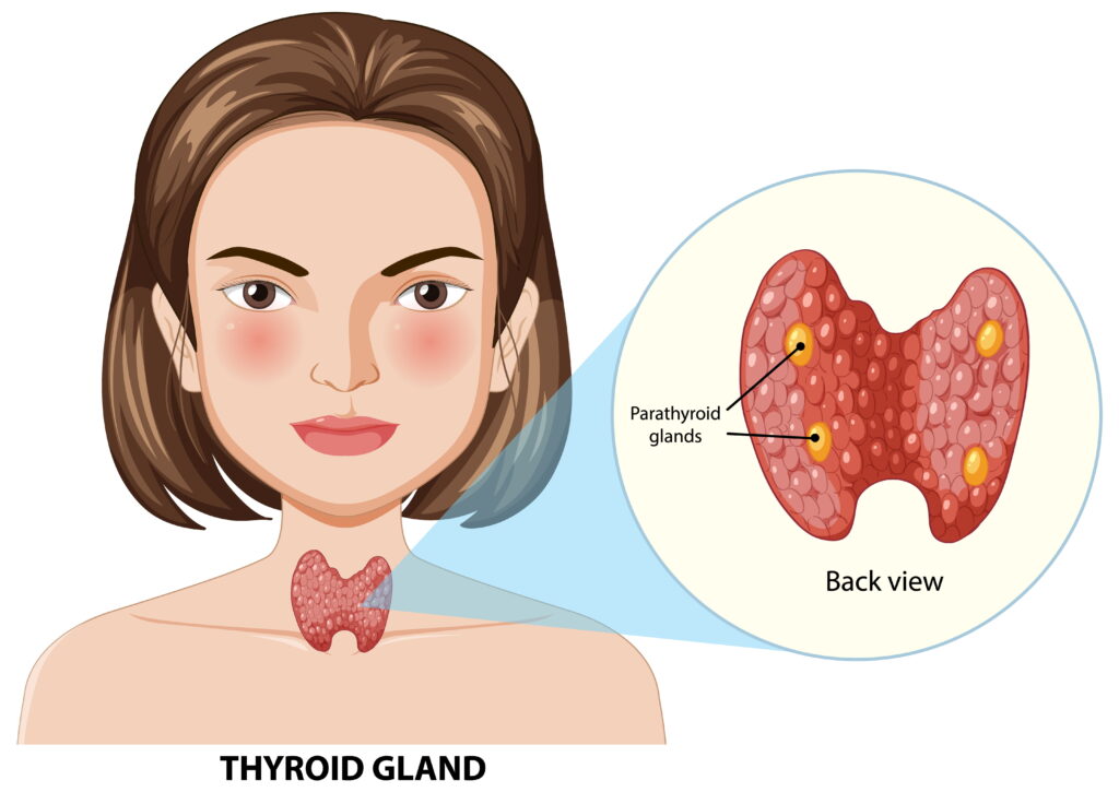 Visual showing homeopathy addressing thyroid disorders through natural remedies.