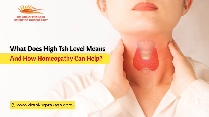 High TSH level indicating thyroid imbalance and homeopathic treatment support