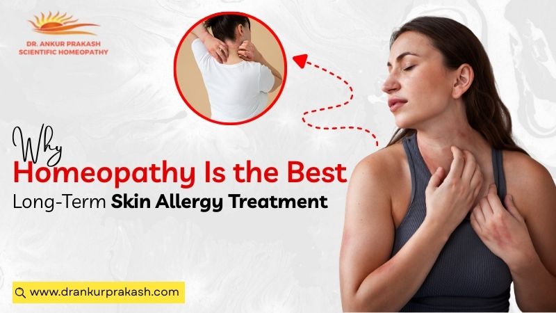 Illustration representing homeopathic remedies and natural ingredients used in a holistic approach to managing long-term skin allergies.