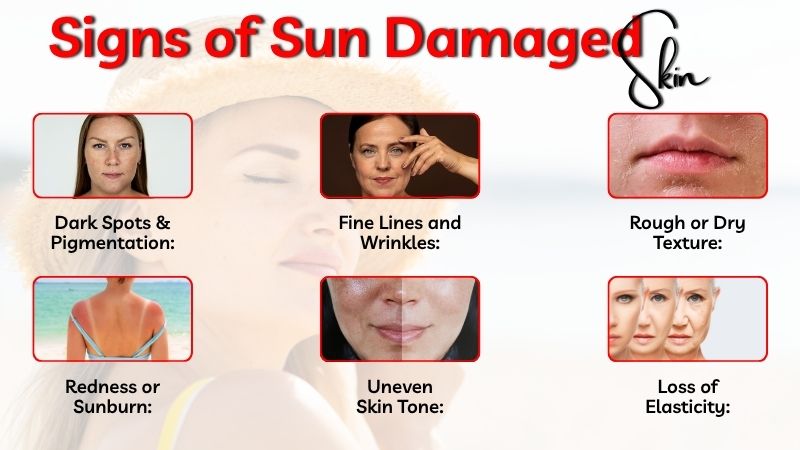 Infographic showing common signs of sun damaged skin including dark spots, wrinkles, dryness, redness, uneven tone, and loss of elasticity.