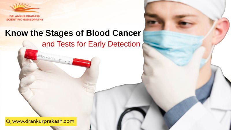 Know the Stages of Blood Cancer and Tests for Early Detection by Dr Ankur Prakash