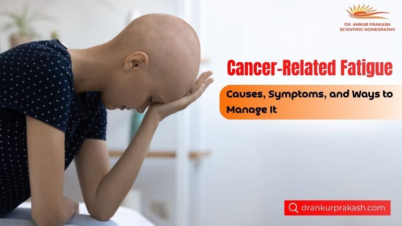 Cancer-Related Fatigue