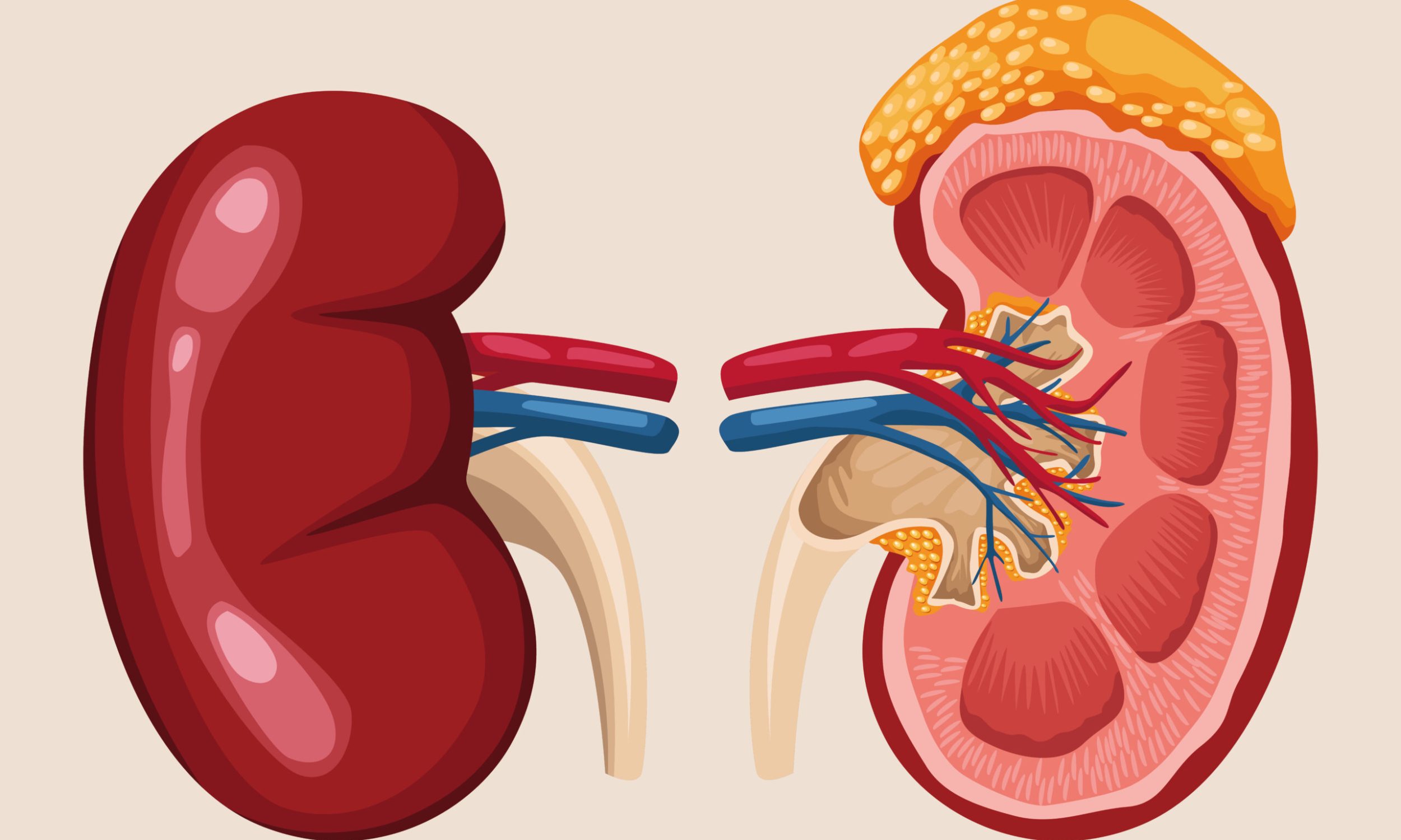 Kidney Treatment with homeopathy
