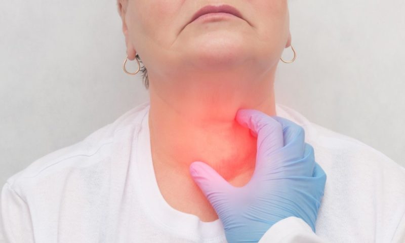 Goiter (Thyroid Enlargement).jpg