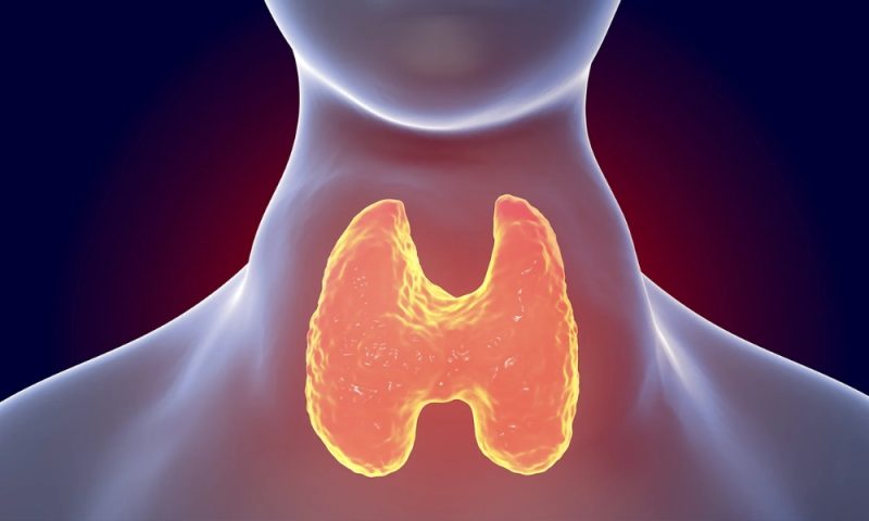 _Graves’ (Autoimmune Hyperthyroidism).jpg